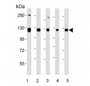 Western blot testing of human 1) HeLa, 2) K562, 3) NCCIT, 4) SH-SY5Y and 5) T-47D cell lysate with ROR2 antibody. Expected molecular weight: 105-130 kDa.