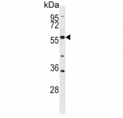 Western blot testing of human HL60 cell lysate with BLK antibody. Expected molecular weight: 55-58 kDa.