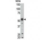 Western blot testing of mouse kidney tissue lysate with BLK antibody. Expected molecular weight: 55-58 kDa.