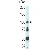 Western blot testing of human HL60 cell lysate with Tyrosine-protein kinase Fer antibody. Predicted molecular weight ~95 kDa.