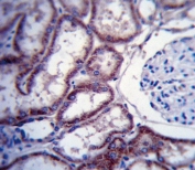 IHC testing of FFPE human kidney tissue with Tyrosine-protein kinase Fer antibody. HIER: steam section in pH6 citrate buffer for 20 min and allow to cool prior to staining.