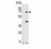 Western blot testing of 1) non-transfected and 2) transfected 293 cell lysate with Spleen tyrosine kinase antibody.