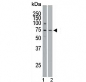 Western blot testing of 1) human ThP-1 and 2) mouse spleen tissue lysate with Spleen tyrosine kinase antibody. Predicted molecular weight ~72 kDa.