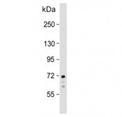 Western blot testing of human Raji cell lysate with Spleen tyrosine kinase antibody. Predicted molecular weight ~72 kDa.