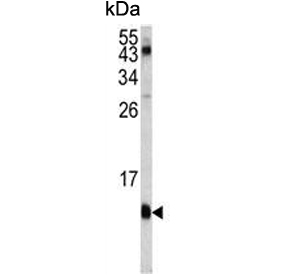 Western blot testing of human Jurkat cell lysate with FKBP1A antibody. Predicted molecular weight ~12 kDa.