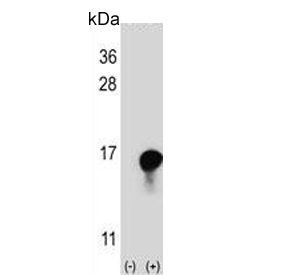 Western blot testing of 1) non-transfected and 2) transfected 293 cell lysate with FKBP1A antibody.