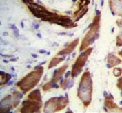 IHC testing of FFPE human skeletal muscle tissue with Filamin A antibody. HIER: steam section in pH6 citrate buffer for 20 min and allow to cool prior to staining.