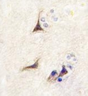 IHC testing of FFPE human brain tissue with Beta-nerve growth factor antibody. HIER: steam section in pH6 citrate buffer for 20 min and allow to cool prior to staining.