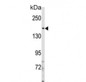 Western blot testing of human HEK293 cell lysate with Insulin receptor substrate 2 antibody. Predicted molecular weight ~137 kDa but it may be observed at up to ~190 kDa due to phosphorylation.