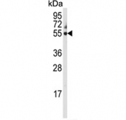 Western blot testing of human HEK293 cell lysate with Cytochrome P450 3A5 antibody. Predicted molecular weight ~57 kDa.