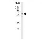 Western blot testing of human SK-BR-3 cell lysate with Cytochrome P450 3A5 antibody. Predicted molecular weight ~57 kDa.