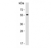 Western blot testing of human liver tissue lysate with Activin receptor type-1B antibody. Predicted molecular weight ~57 kDa.