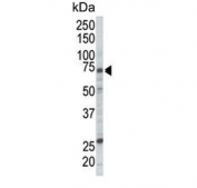 Western blot testing of human Jurkat cell lysate with RAF1 antibody. Predicted molecular weight ~73 kDa.