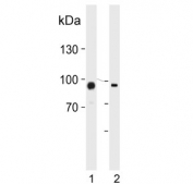Western blot testing of human 1) HUVEC and 2) K562 cell lysate with Protein-glutamine gamma-glutamyltransferase 2 antibody. Predicted molecular weight ~78 kDa.