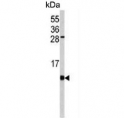 Western blot testing of mouse cerebellum tissue lysate with FKBP1B antibody. Predicted molecular weight ~12 kDa.