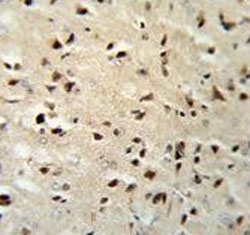 IHC testing of FFPE mouse brain tissue with FKBP1B antibody. HIER: steam section in pH6 citrate buffer for 20 min and allow to cool prior to staining.