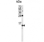 Western blot testing of human HEK293 cell lysate with FKBP1B antibody. Predicted molecular weight ~12 kDa.