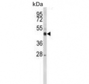 Western blot testing of human MDA-MB-435 cell lysate with Steroid 21-hydroxylase antibody. Expected molecular weight: 52-56 kDa.
