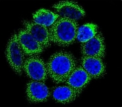 Immunofluorescent staining of human HEK293 cells with Steroid 21-hydroxylase antibody (green) and DAPI nuclear stain (blue).