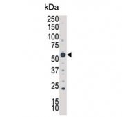 Western blot testing of human A375 cell lysate with SGK3 antibody. Predicted molecular weight ~57 kDa.