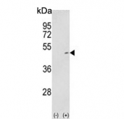 Western blot testing of 1) non-transfected and 2) transfected 293 cell lysate with MAP2K2 antibody.