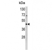 Western blot testing of human Y79 cell lysate with MAP2K2 antibody. Expected molecular weight: 45-50 kDa.