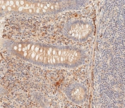 IHC testing of FFPE human epityphlon tissue with PI3K delta antibody. HIER: steam section in pH6 citrate buffer for 20 min and allow to cool prior to staining.