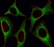 Immunofluorescent staining of fixed and permeabilized human HeLa cells with PI3K delta antibody (green) and anti-Actin (red).