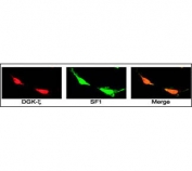 Immunofluorescent staining of fixed and permeabilized human NCI-H295R cells with DGKZ antibody (red) and SF1 antibody (green).