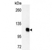 Western blot testing of 1) non-transfected and 2) transfected 293 cell lysate with DGKZ antibody.