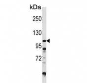 Western blot testing of human Ramos cell lysate with DGKZ antibody. Predicted molecular weight ~104 kDa.