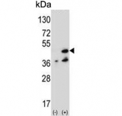 Western blot testing of 1) non-transfected and 2) transfected 293 cell lysate with NME7 antibody.
