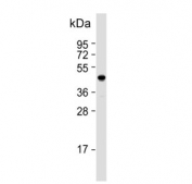 Western blot testing of human A549 cell lysate with NME7 antibody. Predicted molecular weight ~43 kDa.