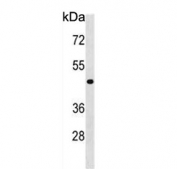 Western blot testing of human T-47D cell lysate with NME7 antibody. Predicted molecular weight ~43 kDa.