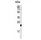 Western blot testing of human HeLa cell lysate with PBP antibody. Predicted molecular weight ~21 kDa.