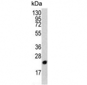 Western blot testing of human Y79 cell lysate with PBP antibody. Predicted molecular weight ~21 kDa.