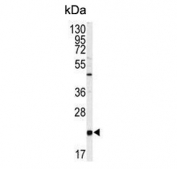 Western blot testing of human HEK293 cell lysate with Phosphatidylethanolamine-binding protein 1 antibody. Predicted molecular weight ~21 kDa.