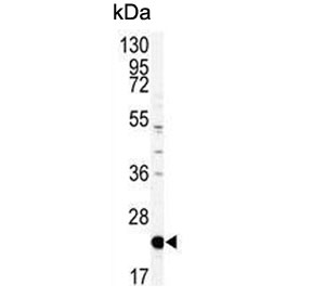 Western blot testing of mouse NIH 3T3 cell lysate with Phosphatidylethanolamine-binding protein 1 antibody. Predicted molecular weight ~21 kDa.