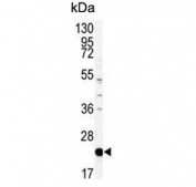 Western blot testing of mouse NIH 3T3 cell lysate with Phosphatidylethanolamine-binding protein 1 antibody. Predicted molecular weight ~21 kDa.