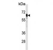 Western blot testing of human HepG2 cell lysate with PEPCK2 antibody. Predicted molecular weight ~71 kDa.