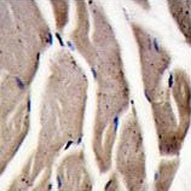 IHC testing of FFPE human skeletal muscle tissue with PFKM antibody. HIER: steam section in pH6 citrate buffer for 20 min and allow to cool prior to staining.