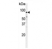 Western blot testing of human HeLa cell lysate with PFKM antibody. Predicted molecular weight ~85 kDa.