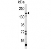 Western blot testing of mouse bladder tissue lysate with Brain-specific angiogenesis inhibitor 1 antibody. Predicted molecular weight ~174 kDa.