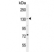 Western blot testing of human K562 cell lysate with Brain-specific angiogenesis inhibitor 1 antibody. Predicted molecular weight ~174 kDa.
