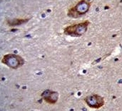 IHC testing of FFPE human brain tissue with Brain-specific angiogenesis inhibitor 1 antibody. HIER: steam section in pH6 citrate buffer for 20 min and allow to cool prior to staining.