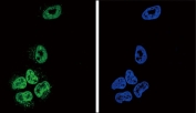 Immunofluorescent staining of human NCI-H460 cells with Phospholipase A2 antibody (green) and DAPI nuclear stain (blue).