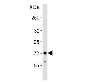 Western blot testing of human Jurkat cell lysate with ZFP823 antibody. Predicted molecular weight ~70 kDa.