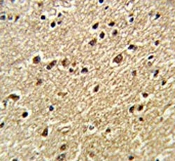 IHC testing of FFPE human brain tissue with ZFP823 antibody. HIER: steam section in pH6 citrate buffer for 20 min and allow to cool prior to staining.