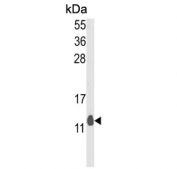 Western blot testing of mouse lung tissue lysate with PEA15 antibody. Predicted molecular weight ~15 kDa.