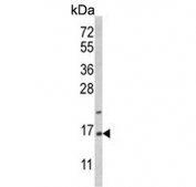 Western blot testing of human T-47D cell lysate with PEA15 antibody. Predicted molecular weight ~15 kDa.